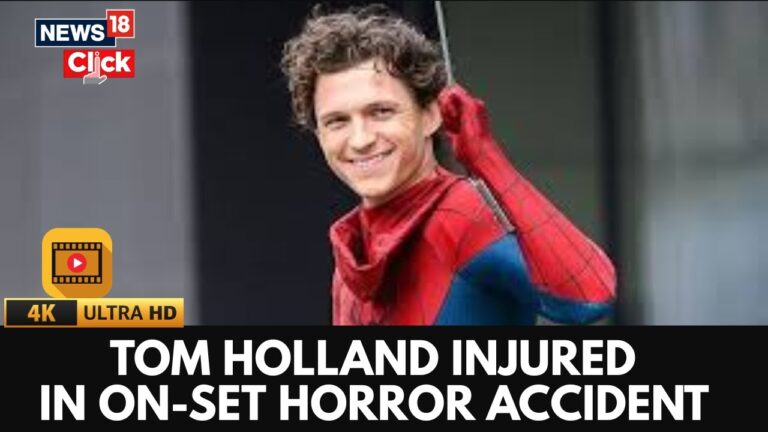 tom-holland-injury-99.jpeg