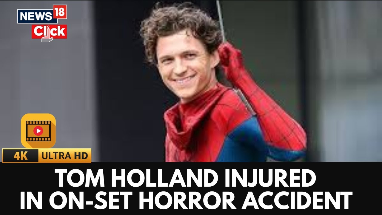 tom-holland-injury-99.jpeg