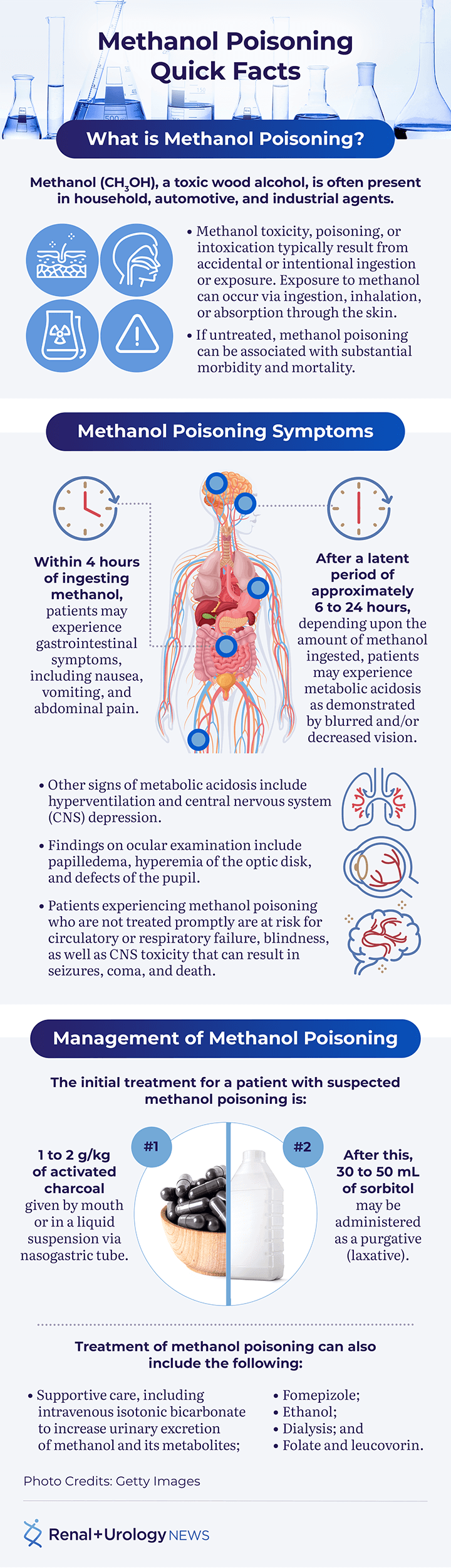 methanol-poisoning-156.png