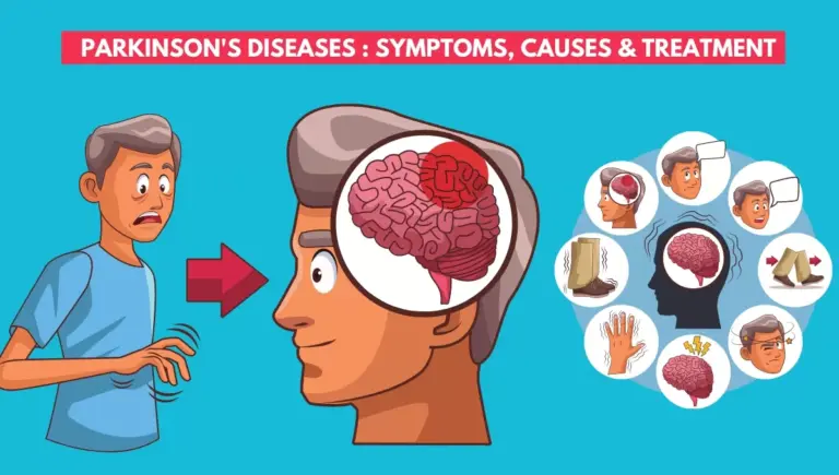 parkinson-s-disease-118.webp