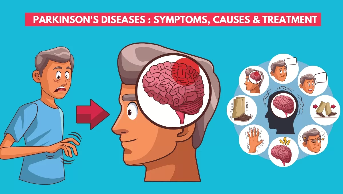 parkinson-s-disease-118.webp