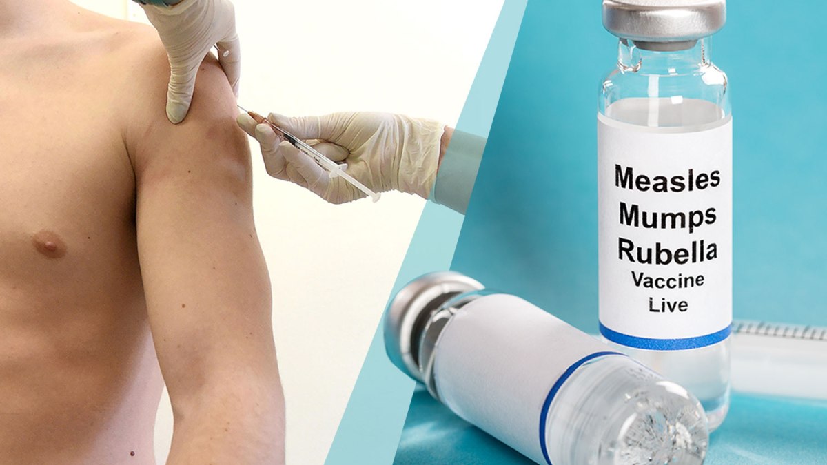 measles-78.jpeg